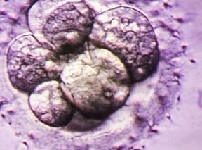 生殖器疱疹怎么治疗？别因你的不重视“害”了自己